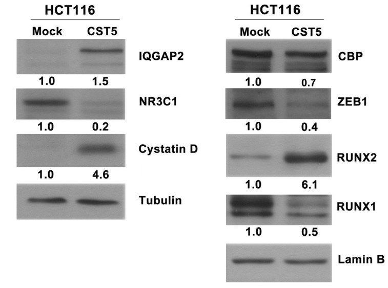 Western blot analysis (20 μg of total cell extracts) of the expression in HCT116-CST5.jpg
